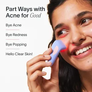 Solawave Bye Acne Spot Treatment | Blue & Red Light Therapy Device for Pimples & Zits | Face Wand Reduces Inflammation, Redness, & Appearance of Blemishes | 3-Min Sessions at Home for Clearer Skin